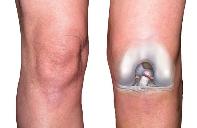 Lesões ligamentares e cirurgia do joelho - Dr. André Costa